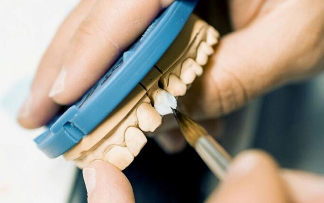 How to Prepare for Dental Implants in Hawaii