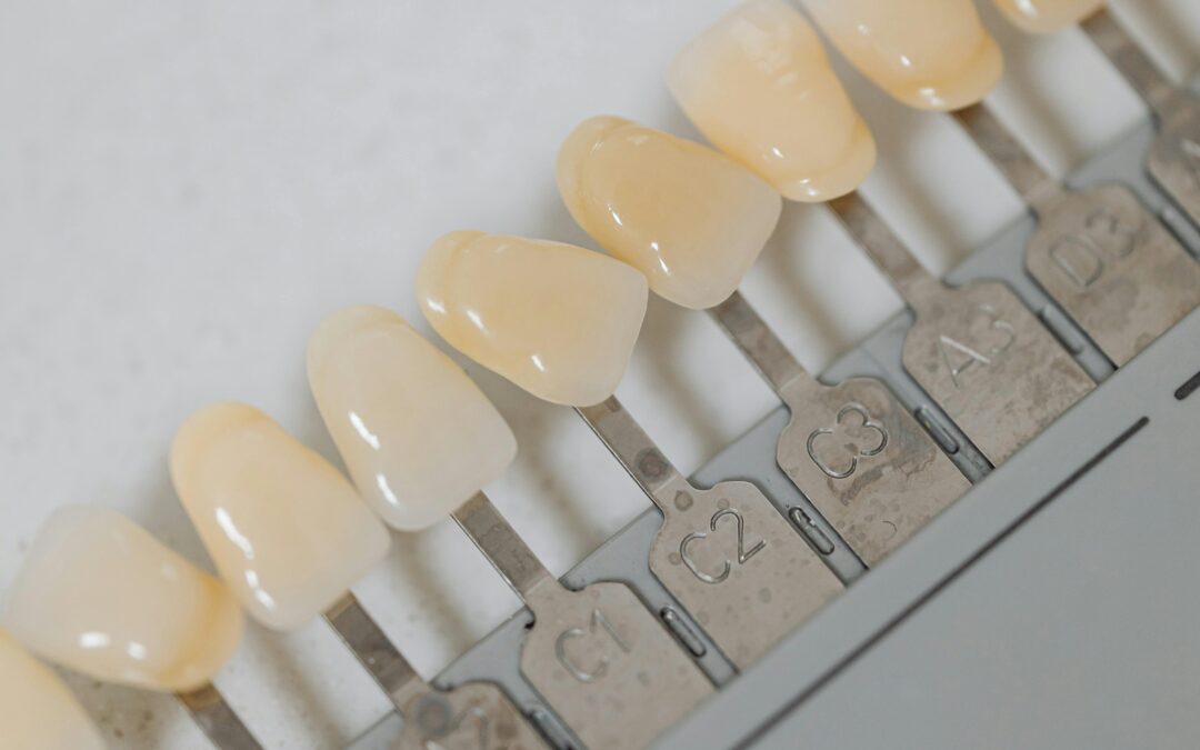 Why Are Dental Implants So Expensive in Hawaii?